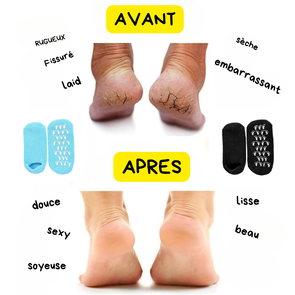 Chaussette en gel Hydratante pour le soin des pieds